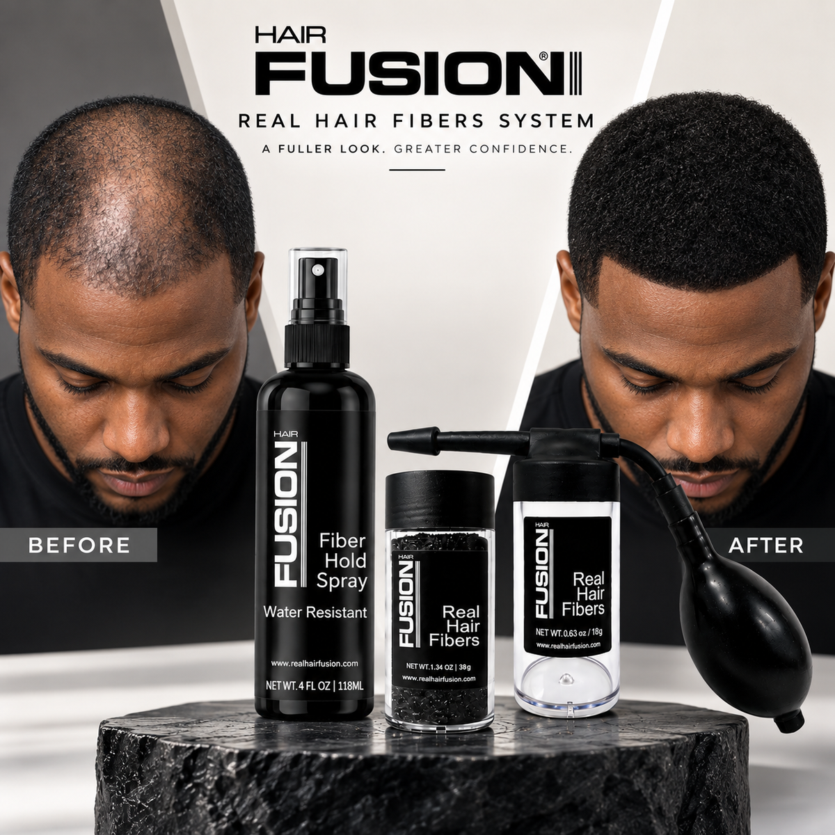 Hair Fusion Complete Hair Fiber Kit – 38g Real Hair Fibers, Fiber Hold Spray & Precision Spray Applicator
